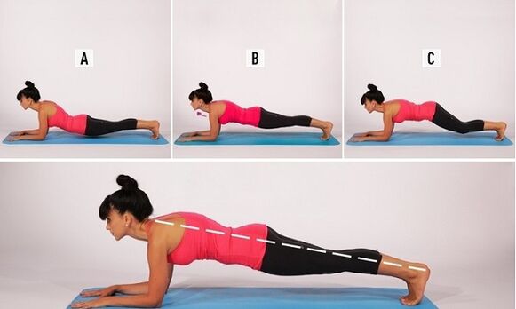 Incorrect and correct technique to perform planks to lose abdominal fat. 